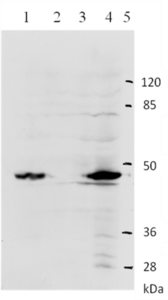 Mouse mAb to HPV11 E2 (clone 4H1)