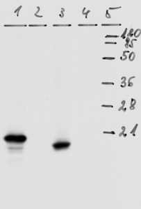Mouse mAb to HPV18 E7 (clone 8E2)