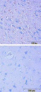 Mouse mAb to human Artemin (clone 1F3)
