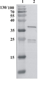 Partially humanized, chimeric recombinant monoclonal antibody to HIV-1 p24 (clone 5)