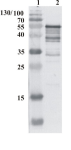 Recombinant antibody HCV 1b NS5B (clone R9A2)