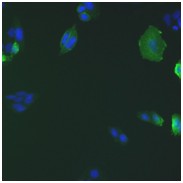 Partially humanized, chimeric recombinant monoclonal antibody to HIV-1 p24 (clone 5)