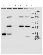 Mouse mAb to HPV18 E7 (clone 10A8)