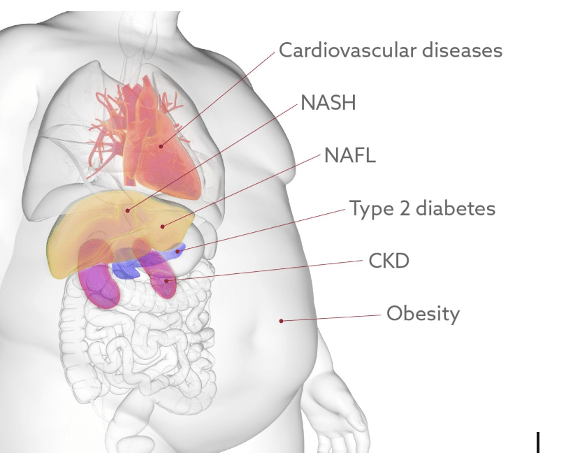 RBP4 antibodies support the identification of cardiovascular diseases, NASH, NAFL, type 2 diabetes, CKD, obesity.